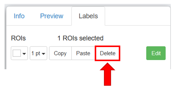 figure_rois_delete.png