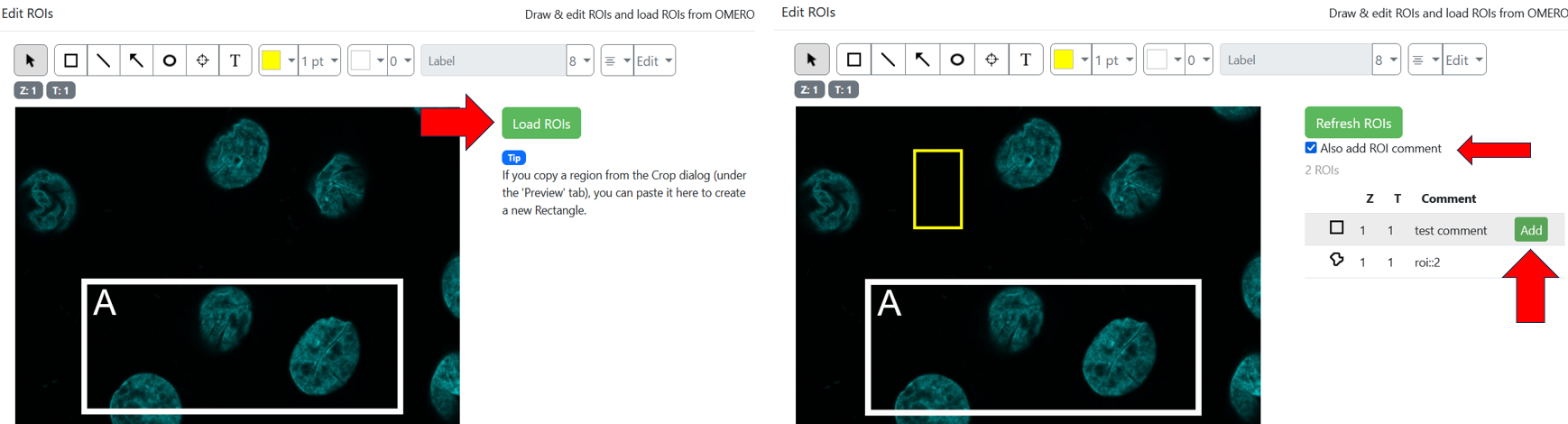 figure_rois_edit_load.png