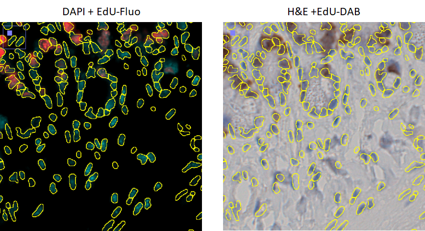 cell-detection.png