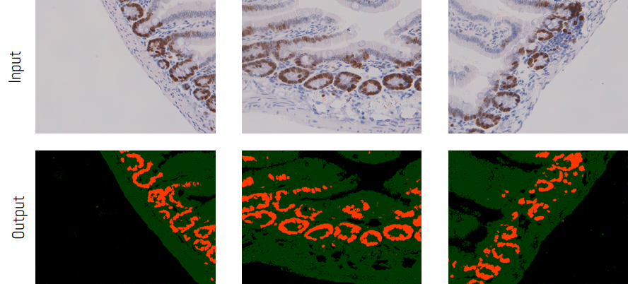 color-deconvolution-auto-threshold.png